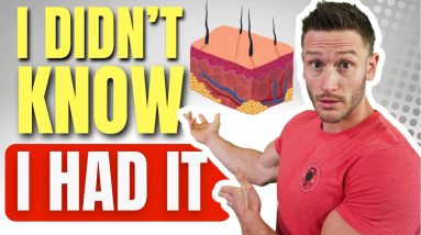 The MAJOR SIGN of Insulin Resistance | What it FEELS Like