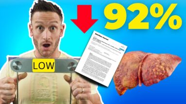 The Most Impressive Results with FATTY LIVER I've Ever Seen (over 90% reduction)