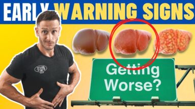 The Four EARLY Signs of Fatty Liver Disease (NAFLD) - How to Fix it Early