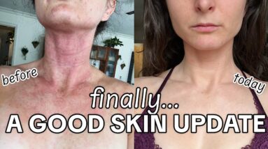 Training + Diet + Skin Updates for the New Year 🥳