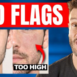 The Skin Sign Your Cortisol is Too High (Stress, Fasting, Diet)