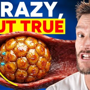 This Hormone is Worse Than Cortisol for Belly Fat (Exercise Makes It Worse)