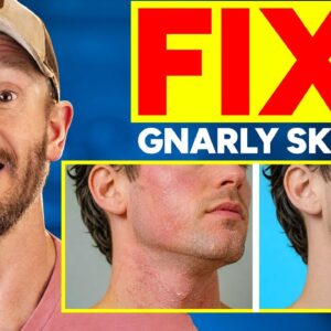 ½ Cup Clears Bad Skin and Drops Skin Inflammation