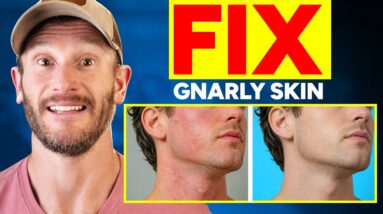 ½ Cup Clears Bad Skin and Drops Skin Inflammation