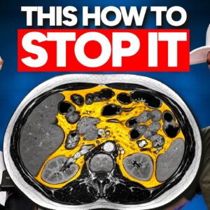 This Ends Insulin Resistance Over Age 40 (and it’s not eating less)