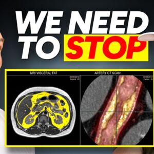 Insulin Resistance Doctor: Stop 16:8 Fasting Now (Do This Fasting Instead)