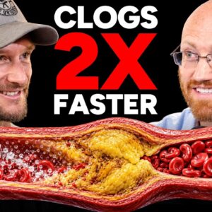 Artery Doctor: This Just Changed Everything About Plaque and Heart Disease